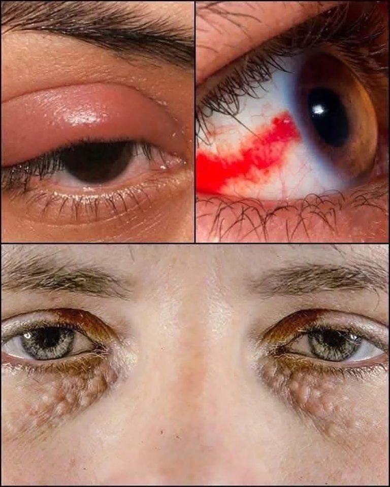 A co jeśli Twoje oczy próbują Ci coś powiedzieć?