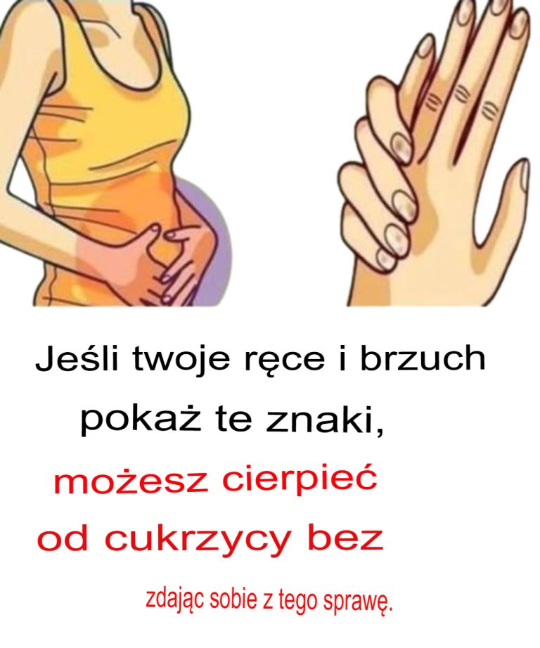 Jeśli Twoje dłonie i brzuch wykazują takie objawy, możesz cierpieć na cukrzycę, nie zdając sobie z tego sprawy