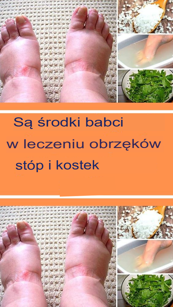 11 domowych sposobów na opuchnięte stopy i kostki Oto