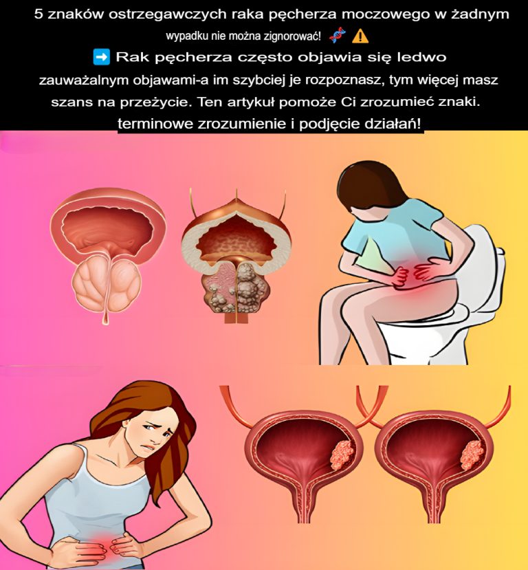 5 ostrzegawczych objawów raka pęcherza moczowego