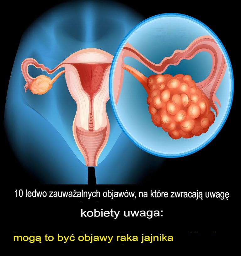 10 subtelnych objawów, na które kobiety powinny zwrócić uwagę: mogą być oznakami raka jajnika