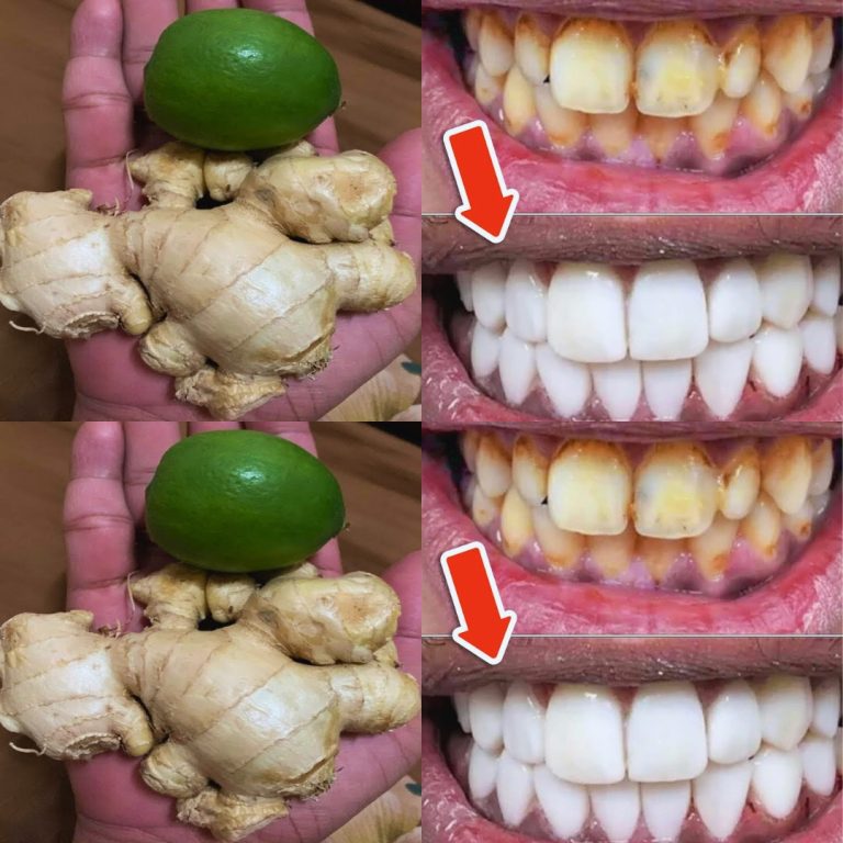 Wybiel swoje żółte zęby cytryną i imbirem