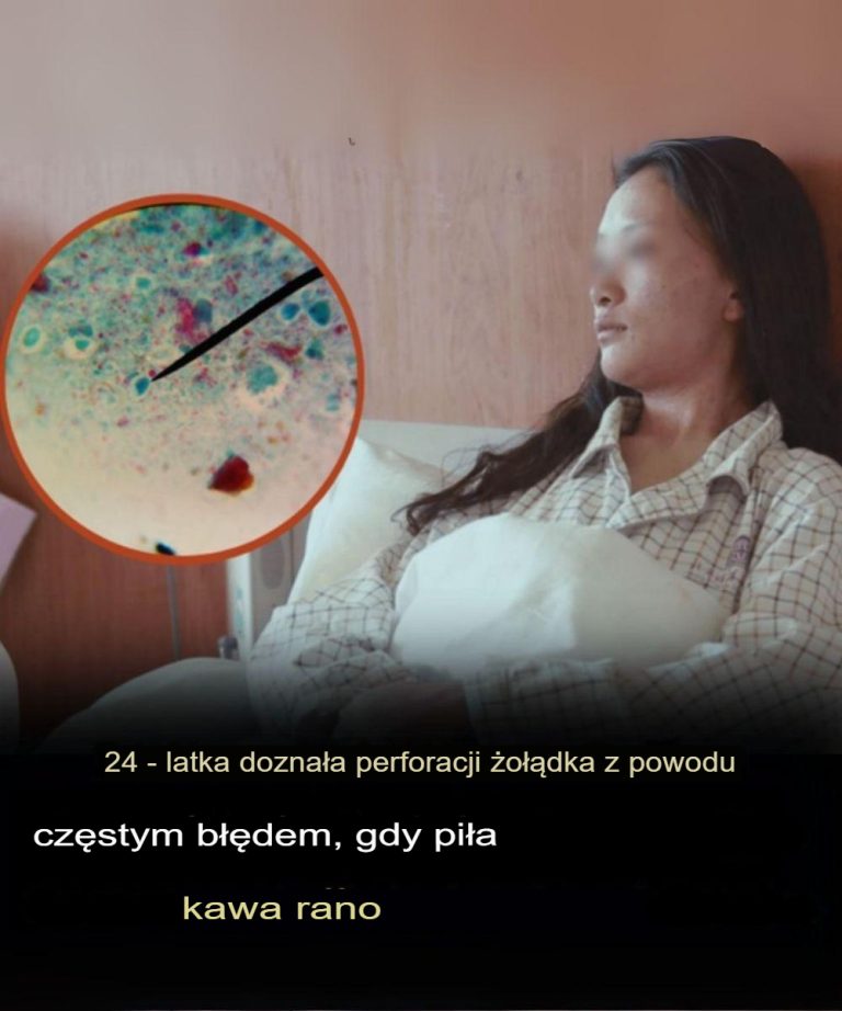 24-letnia kobieta doznała perforacji żołądka w wyniku częstego błędu podczas picia porannej kawy