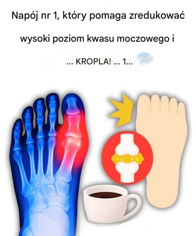 „Mój duży palec u nogi płonął… Dopóki nie odkryłem tych 5 napojów, które naturalnie eliminują kwas moczowy!”
