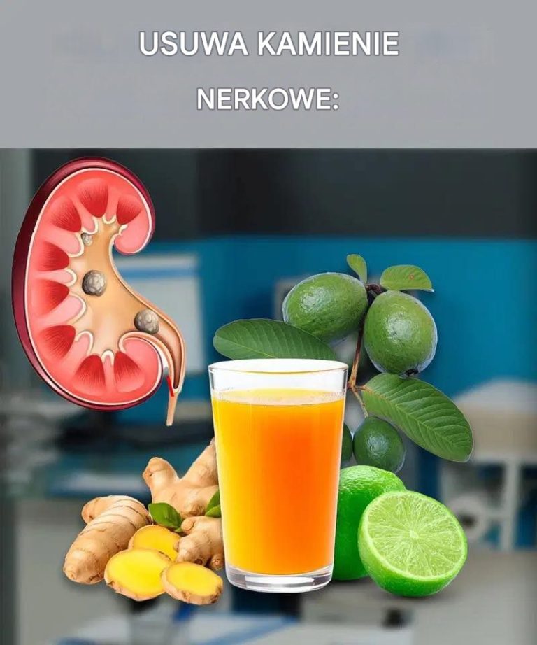 Napój, który w mgnieniu oka usuwa kamienie nerkowe