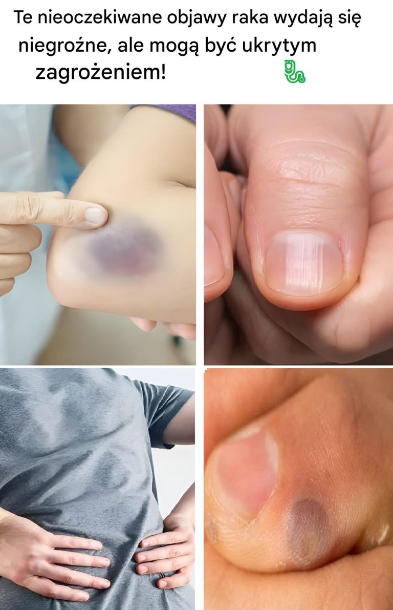 Nietypowe objawy raka, które prawdopodobnie ignorujesz