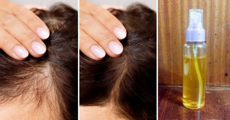 Jak używać octu jabłkowego, aby szybko zapuścić włosy