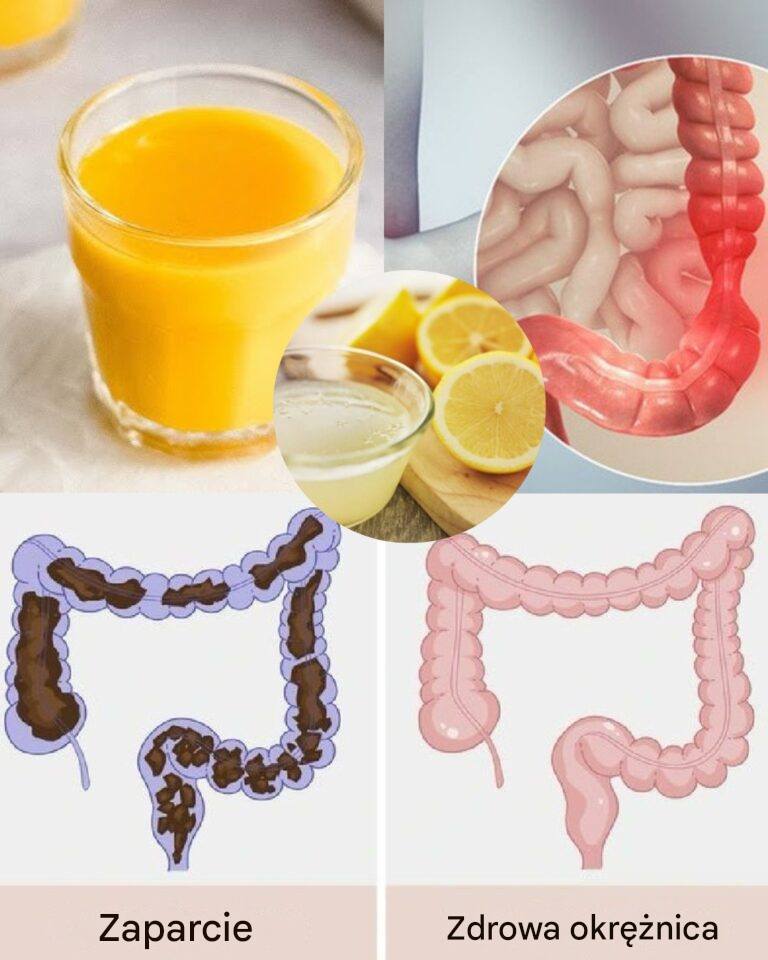 Wprowadzenie: Dlaczego zdrowie jelit jest wszystkim