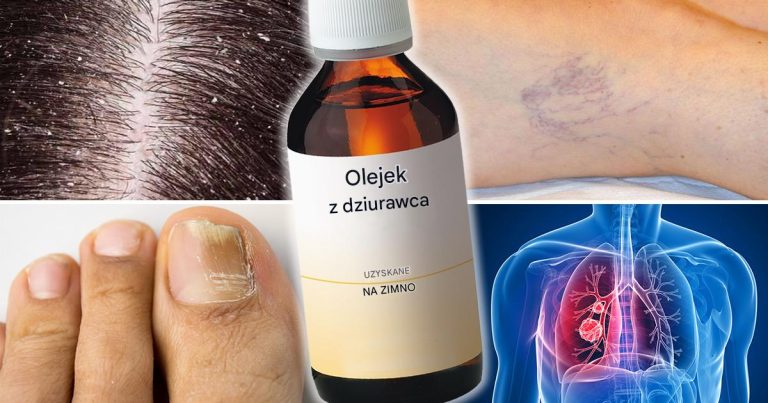 Do czego służy olejek z dziurawca i jak go stosować? Jest to jeden z najskuteczniejszych olejków przeciwzapalnych i antybakteryjnych.