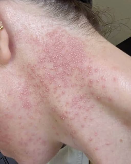 Dowiedz się, jak niektóre pokarmy wpływają na twoje ciało