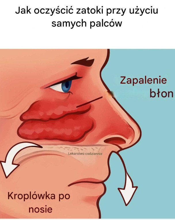 Jak oczyścić zatoki przy użyciu samych palców? Naturalna metoda na ulgę i oczyszczenie!