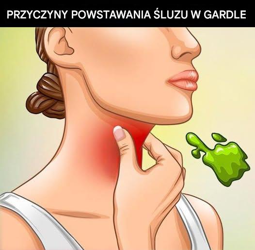 Prawdziwe przyczyny ciągłego zalegania śluzu w gardle i jak się go pozbyć