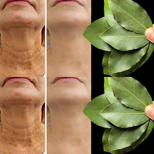 Czy liść laurowy jest 100 000 razy silniejszy niż botoks? | Naturalny sposób na usuwanie zmarszczek nawet w wieku 70 lat!