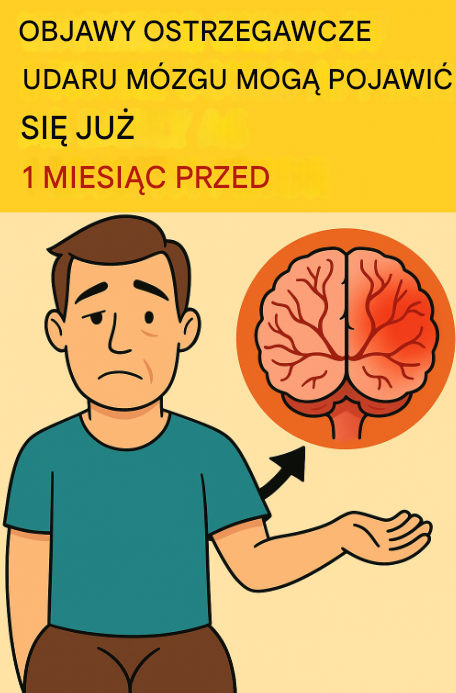 Objawy ostrzegawcze udaru mogą pojawić się już na 1 miesiąc przed udarem