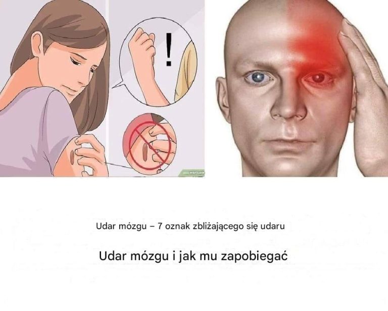 Miesiąc przed udarem Twój organizm Cię ostrzega: 10 sygnałów, których nie należy ignorować