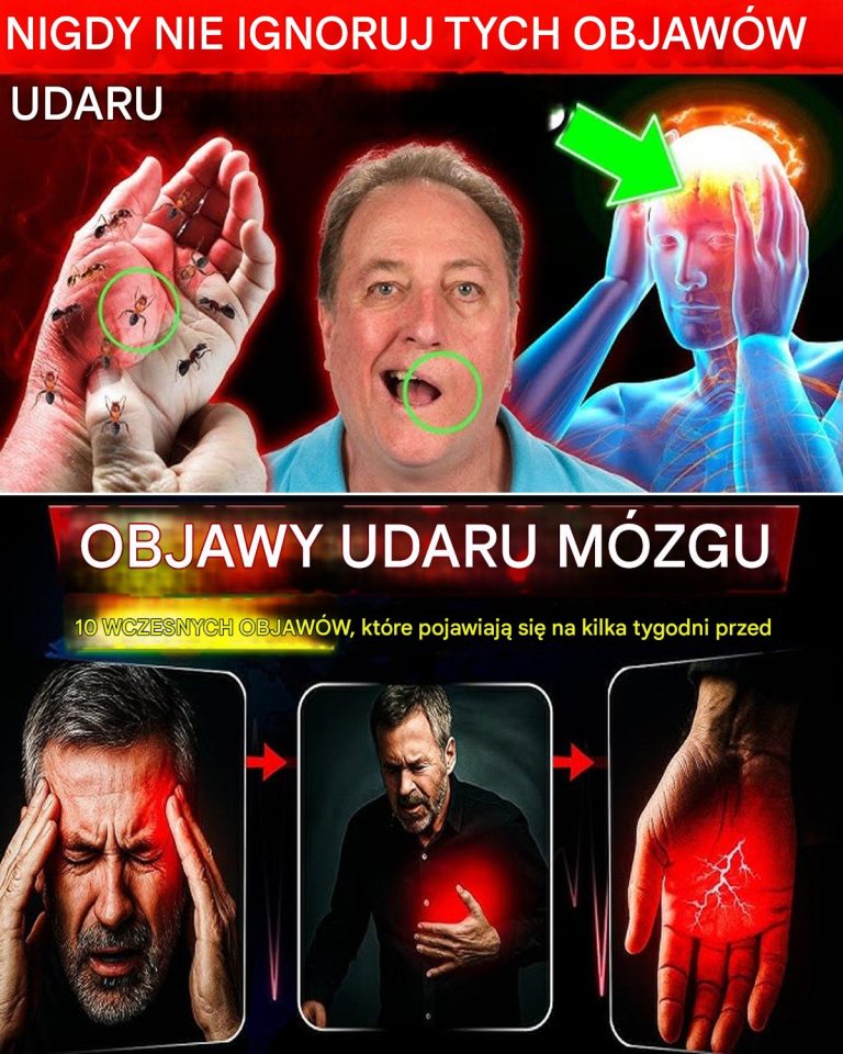 Wykryj te 10 objawów udaru mózgu tydzień wcześniej