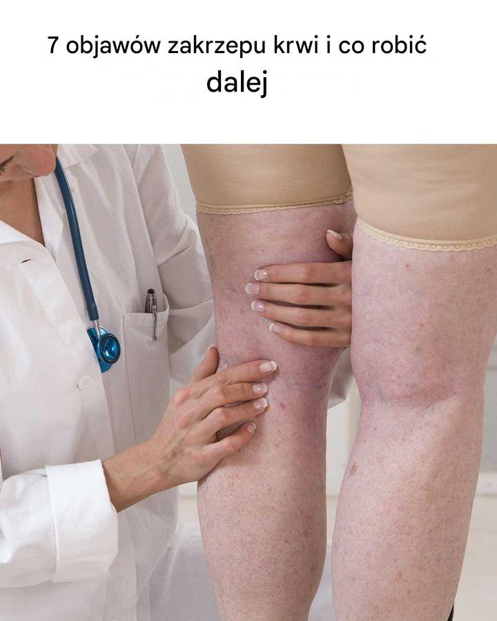 Bardzo przydatne! Będę na nie uważać.