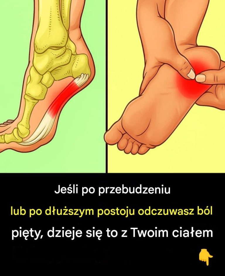 7 skutecznych ćwiczeń łagodzących ból pięty i leczących zapalenie powięzi podeszwowej w sposób naturalny