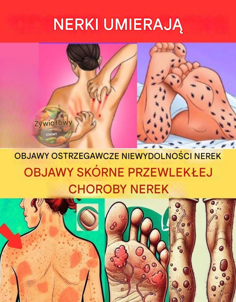 23 Strange Signs of Kidney Disease Most People Miss — Until It’s Too Late