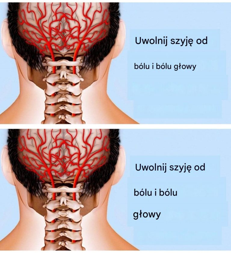 Fizjoterapeuta pokazuje metody łagodzenia bólu szyi i pleców
