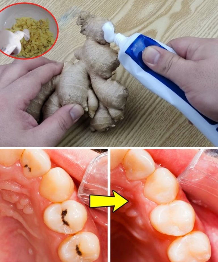 Naturalne sposoby ochrony zębów i zapobiegania próchnicy