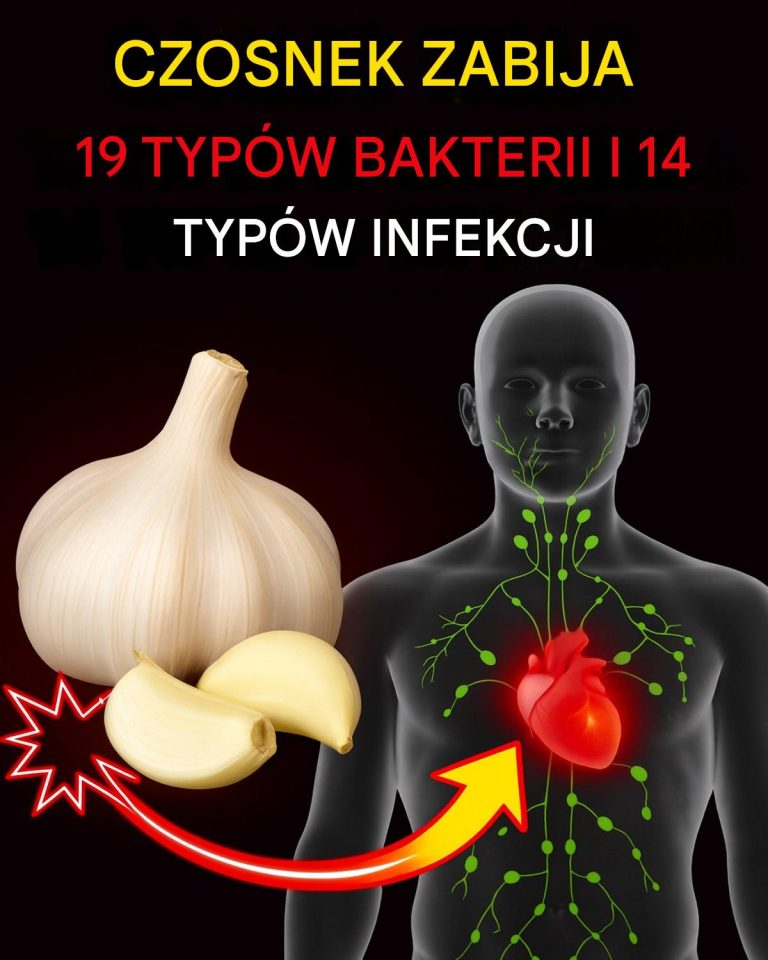 Czy to prawda, że ​​czosnek zabija 14 rodzajów bakterii i 13 rodzajów infekcji?