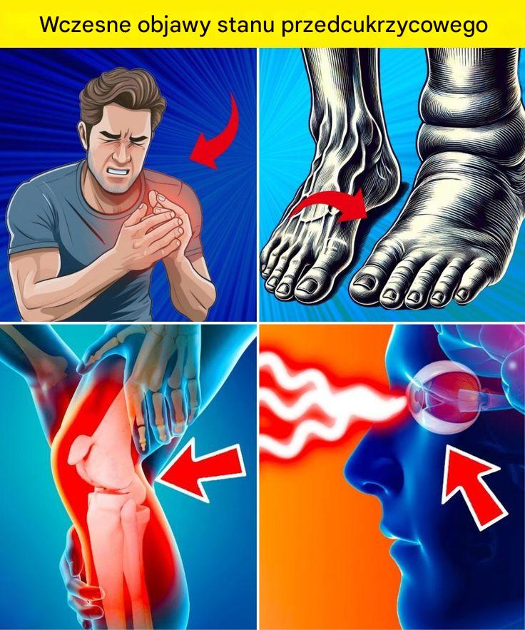 12 oznak, że możesz mieć stan przedcukrzycowy, jak go wykryć i jak go kontrolować