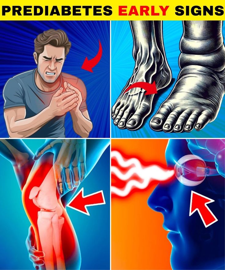 12 oznak, że możesz mieć stan przedcukrzycowy, jak go wykryć i jak go kontrolować12 oznak, że możesz mieć stan przedcukrzycowy, jak go wykryć i jak go kontrolować