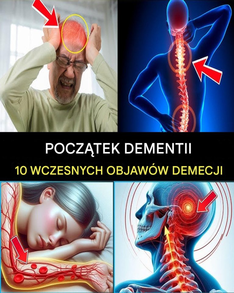 7 WCZESNYCH OBJAWÓW CHOROBY ALZHEIMERA, KTÓRYCH NIGDY NIE NALEŻY IGNOROWAĆ!