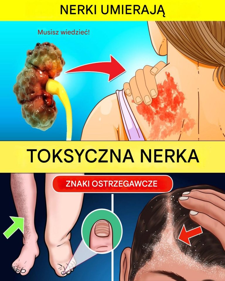 9 ostrzegawczych sygnałów, że Twoje nerki zawodzą | Badania, które pomogą uniknąć dializ