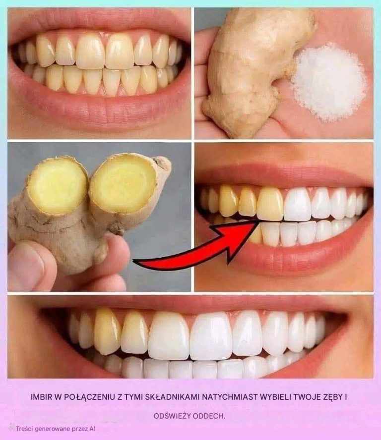 Przepis na imbir i sól, który naturalnie wybiela zęby i odświeża oddech