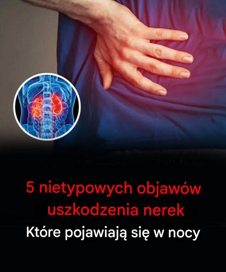 Wskazówki nocne: 5 rzadkich objawów wskazujących na uszkodzenie nerek