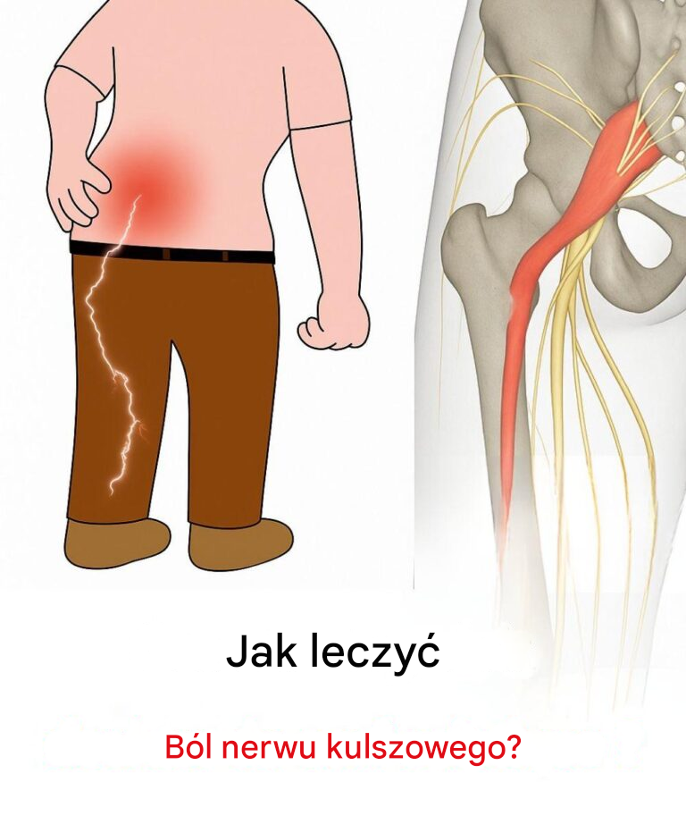 3 oefeningen om ischiaspijn in het was te verlichten: praktyczne w skutecznym