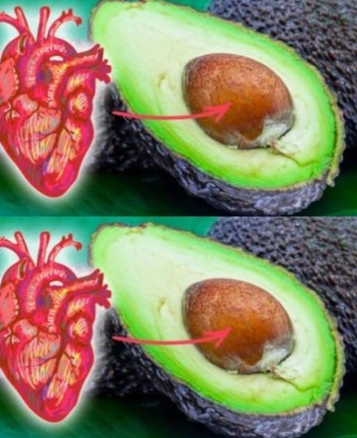 Ta kobieta jadła jedno awokado dziennie przez lata! Miesiąc później przydarzyło jej się to samo.