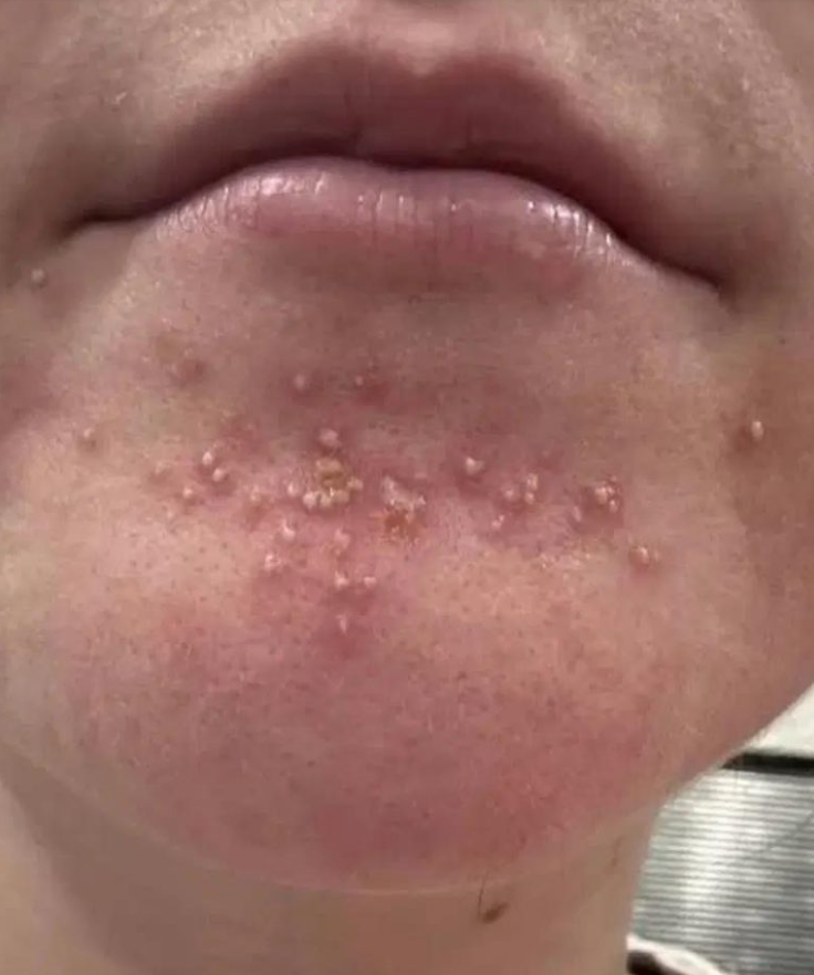 Uważaj! Oto konsekwencje spania z…