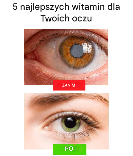 5 najlepszych witamin dla Twoich oczu