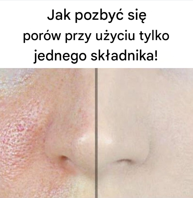 Jak pozbyć się porów za pomocą tylko jednego składnika! (link w komentarzach)