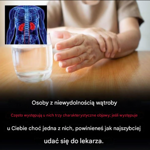 Niewydolność wątroby: zrozumienie widocznych objawów i wyzwań związanych z tą ukrytą chorobą