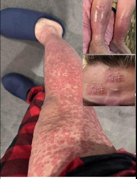 Spanie w brudnych ubraniach: ryzyko dla zdrowia, o którym wiele osób nie wie