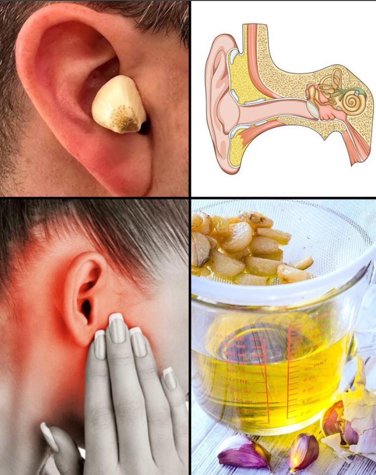 Czosnek dla zdrowia uszu: naturalna ulga i ochrona