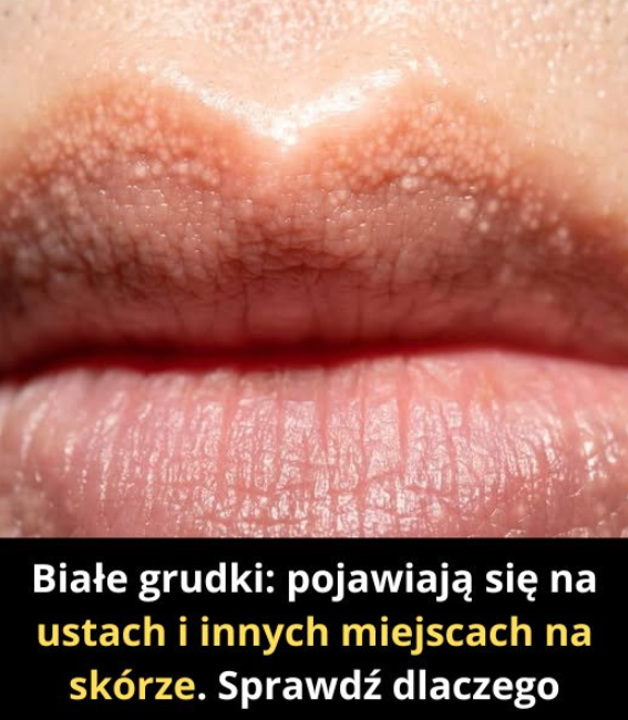 Możesz je zauważyć w nieoczekiwanych miejscach… Sprawdź komentarze, aby wiedzieć co robić