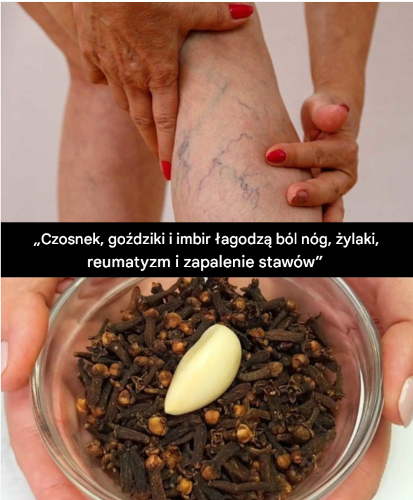 Środek z czosnku, goździków i imbiru na ból nóg, reumatyzm i artretyzm