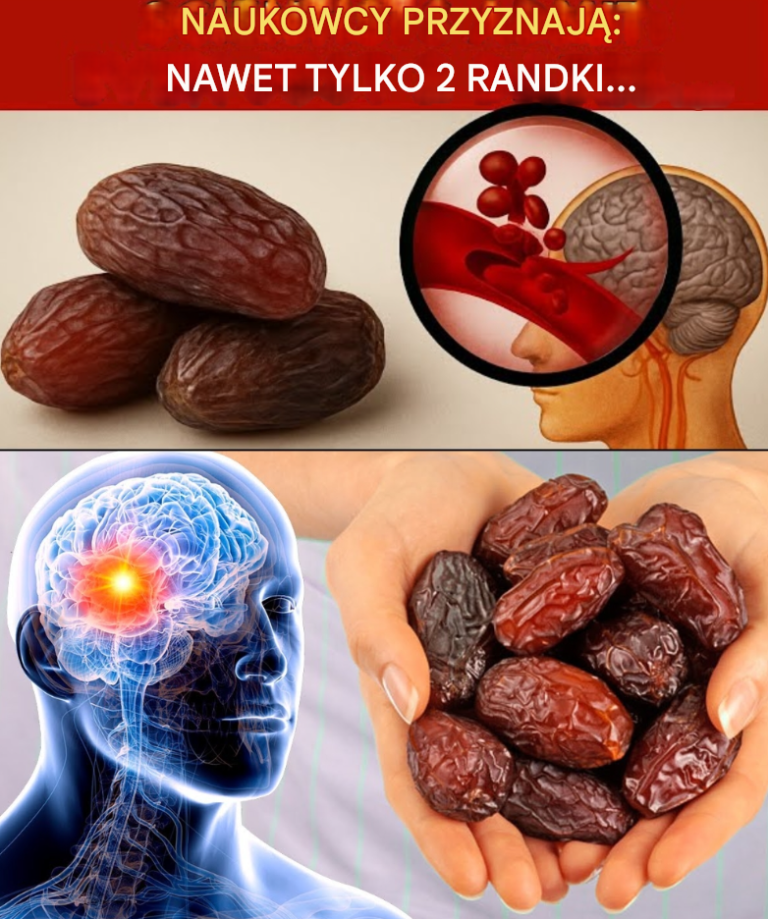 Co się stanie z Twoim ciałem, jeśli będziesz jeść 2 daktyle dziennie przez 30 dni?