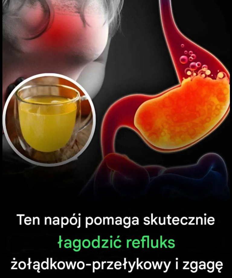 Ten napój pomaga skutecznie łagodzić refluks żołądkowo-przełykowy i zgagę