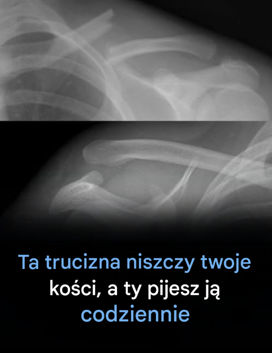 Ten napój niszczy kości od wewnątrz, a mimo to wszyscy go piją.