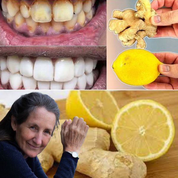 Naturalne sposoby na wybielanie zębów