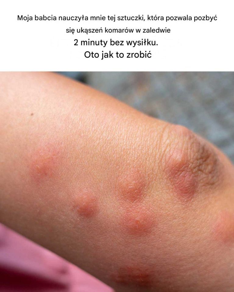 Wiedziałeś o tym? Wow, dowiedziałem się czegoś nowego!