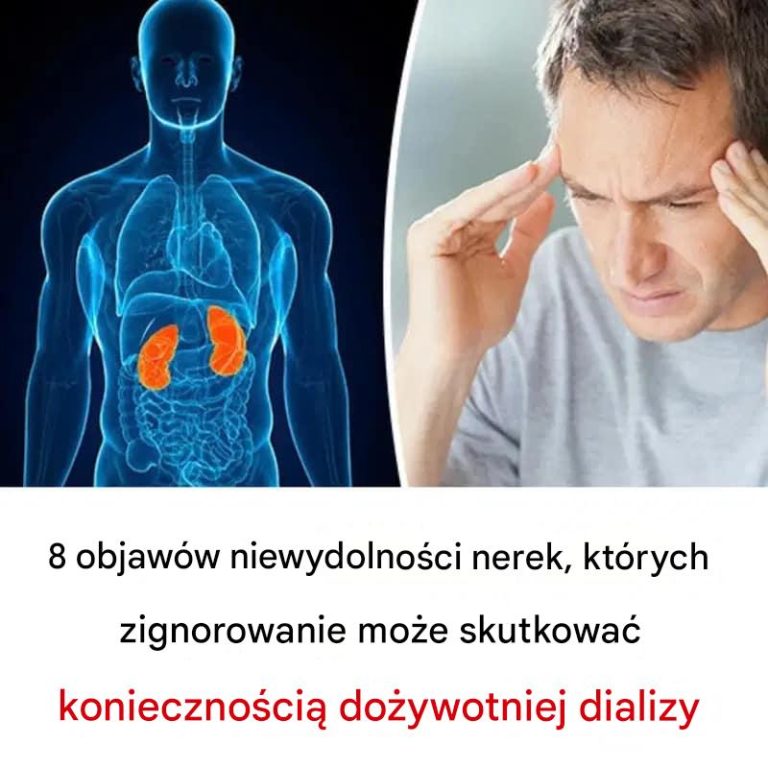 8 objawów niewydolności nerek, których zignorowanie może skutkować koniecznością dożywotniej dializy