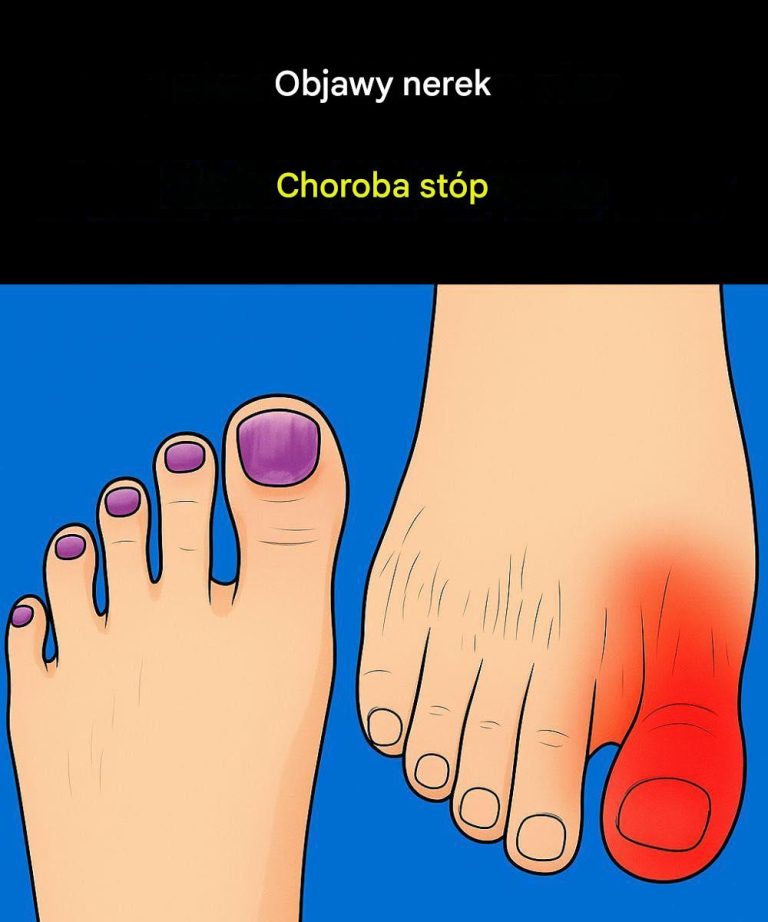 Objawy choroby nerek w stopach