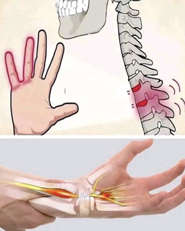 Mrowienie i drętwienie rąk i nóg: wyjaśnienie i ostrzeżenia